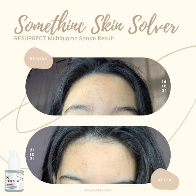 Somethinc Resurrect Multibiome Serum review photo by kiarafelisha