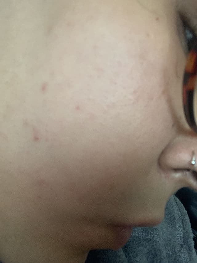 Superdrug Me+ Hyaluronic Booster review photo by kika