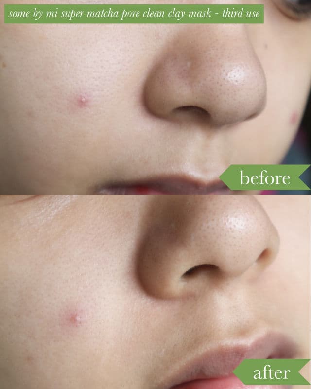 Some By Mi Super Matcha Pore Clean Clay Mask review photo by kimsgooddays