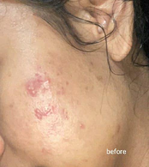 Purivera Malachite Whitening Toner  review photo by adelaidegina