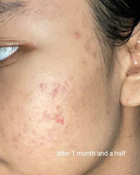 Purivera Malachite Whitening Toner  review photo by adelaidegina