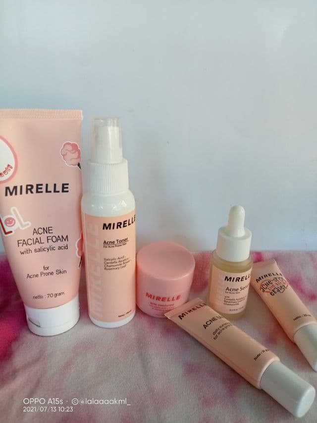 Mirelle Acne Toner review photo by lalaaaavi