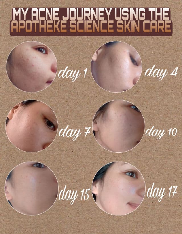 Apotheke Science Pure Castile Facial Wash review photo by lgvegafria