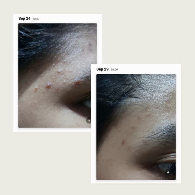 datglowskin Skinpair Serum review photo by lilactosky