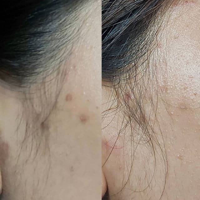 Bhumi C+ Brightening Booster review photo by lilactosky