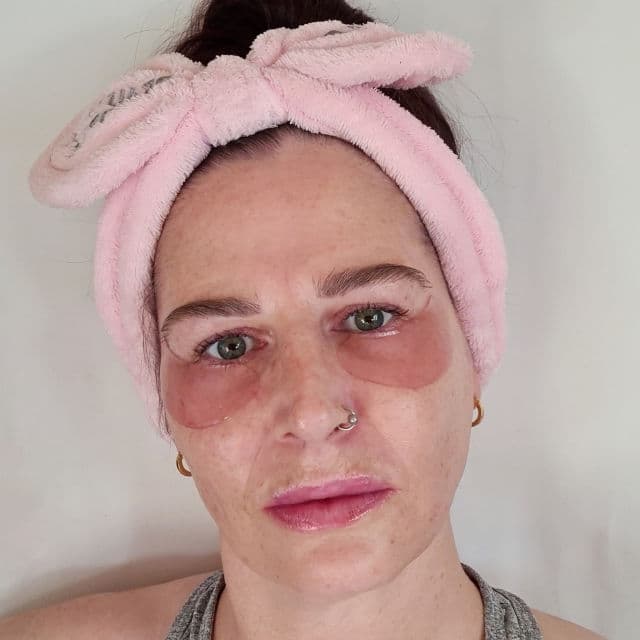 JMsolution Believe In Nature Pomegranate Eye Pads review photo by lindseyprry