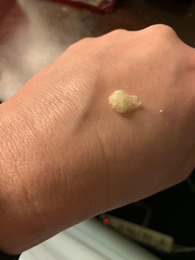 Retin-A Micro Tretinoin Gel Microsphere 0.1% review photo by lizziemichelle