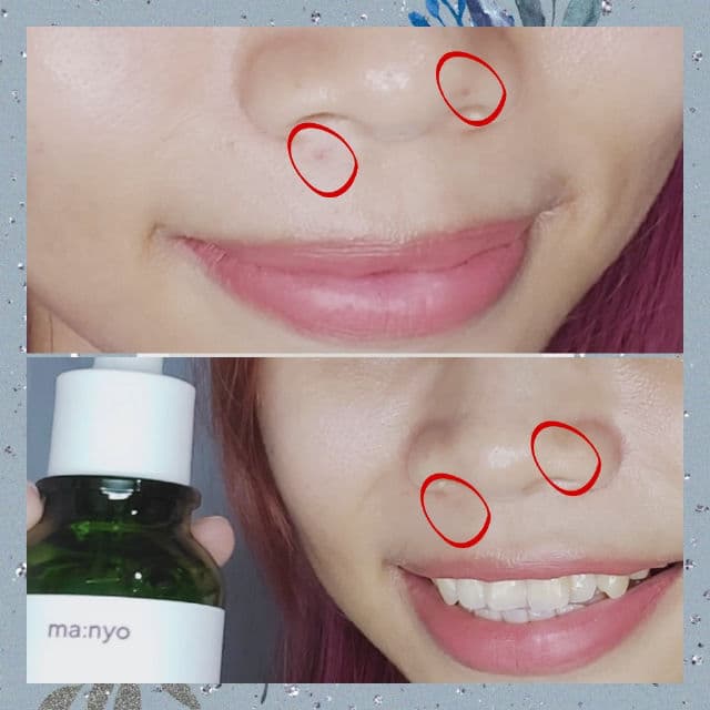 manyo Bifida Cica Herb Serum review photo by luaeiv