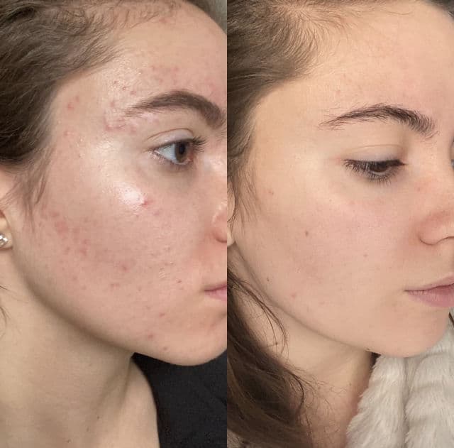 iS Clinical Active Serum review photo by luciar