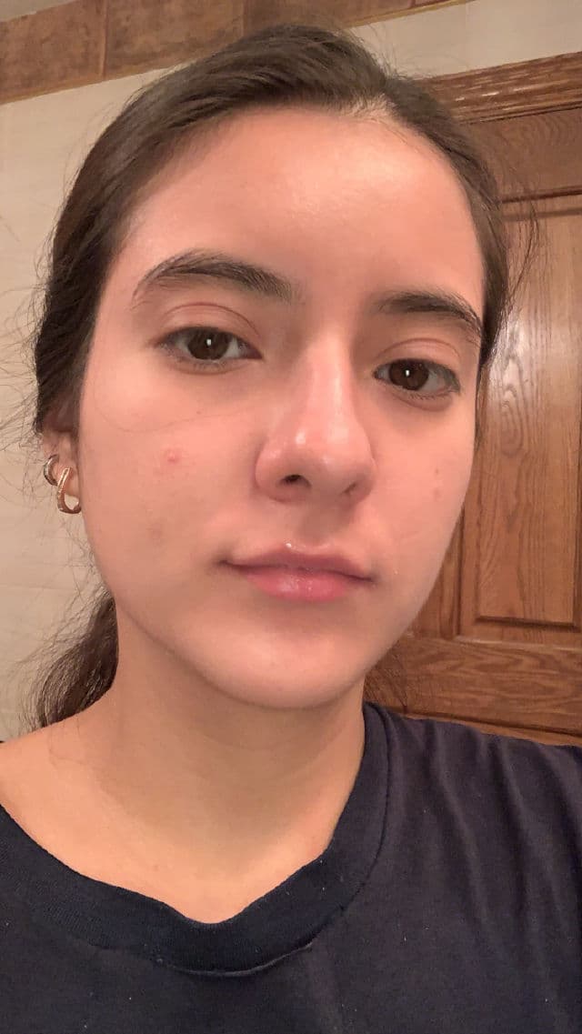 SkinMedica Ultra Sheer Moisturizer review photo by lulupiment