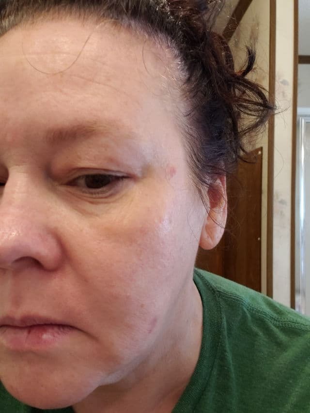 Soon Skincare Golden Eye 24K Gold Hydrogel Eye Patches review photo by lynncochran71