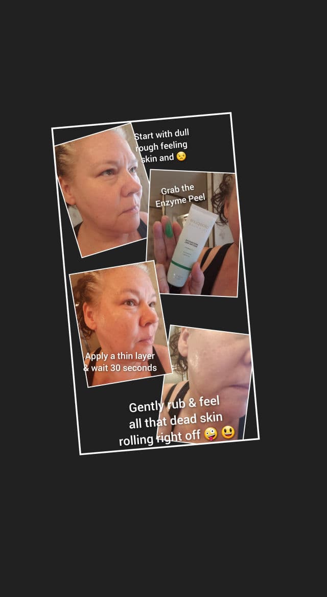 Aloette Restorative Enzyme Peel Exfoliating Gel review photo by lynncochran71