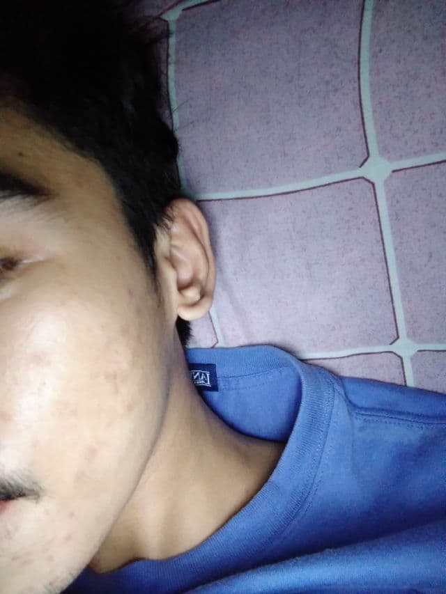 Celeteque DermoScience Acne Solutions Oil Control Toner review photo by markep