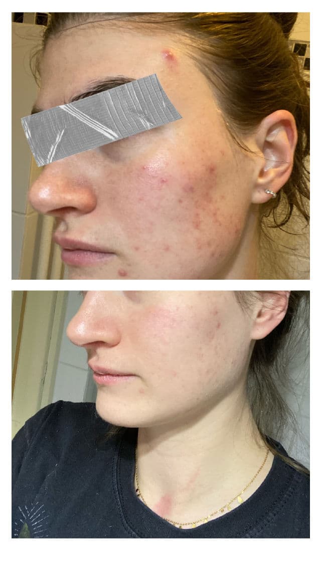 Paula's Choice CBD Skin Transformative Treatment Milk review photo by meertje