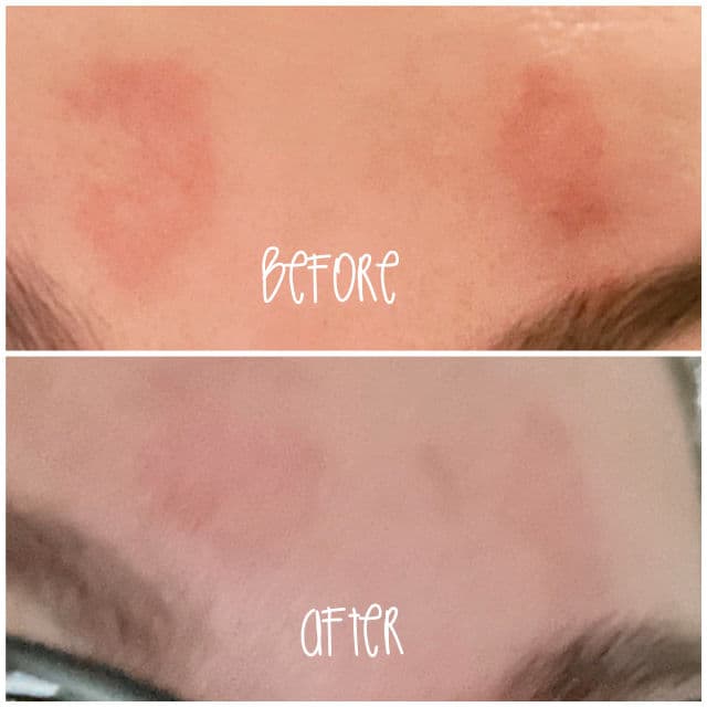 Acure Seriously Soothing Blue Tansy Night Oil review photo by memyskinandi