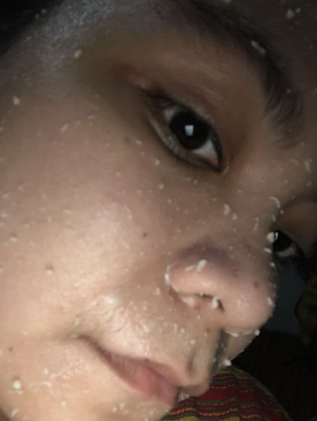 The Yeon Vita7 Energy Peeling Gel review photo by mizzyzi