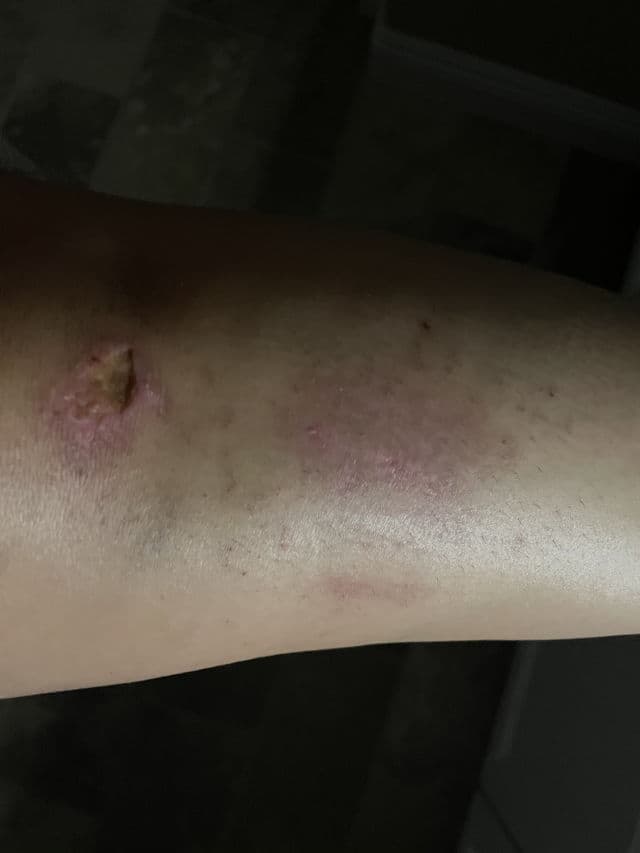 Jason Naturals Maximum Strength Vitamin E 45,000 I.U. Pure Natural Skin Oil review photo by mommyhaase