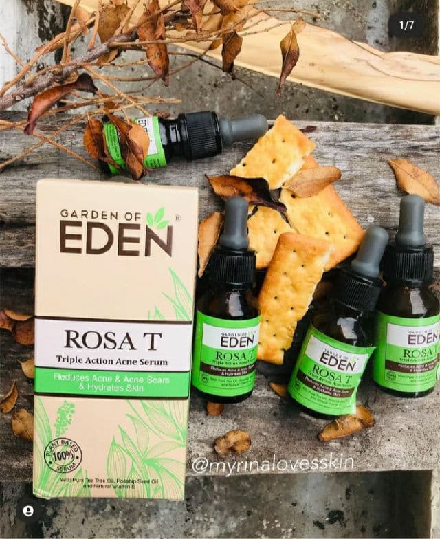 Garden of Eden Rosa T Triple Action Acne Serum review photo by myrinA