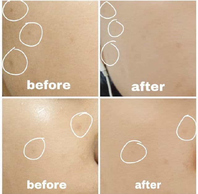 The Ordinary 100% Organic Cold-Pressed Rose Hip Seed Oil review photo by naysskincare