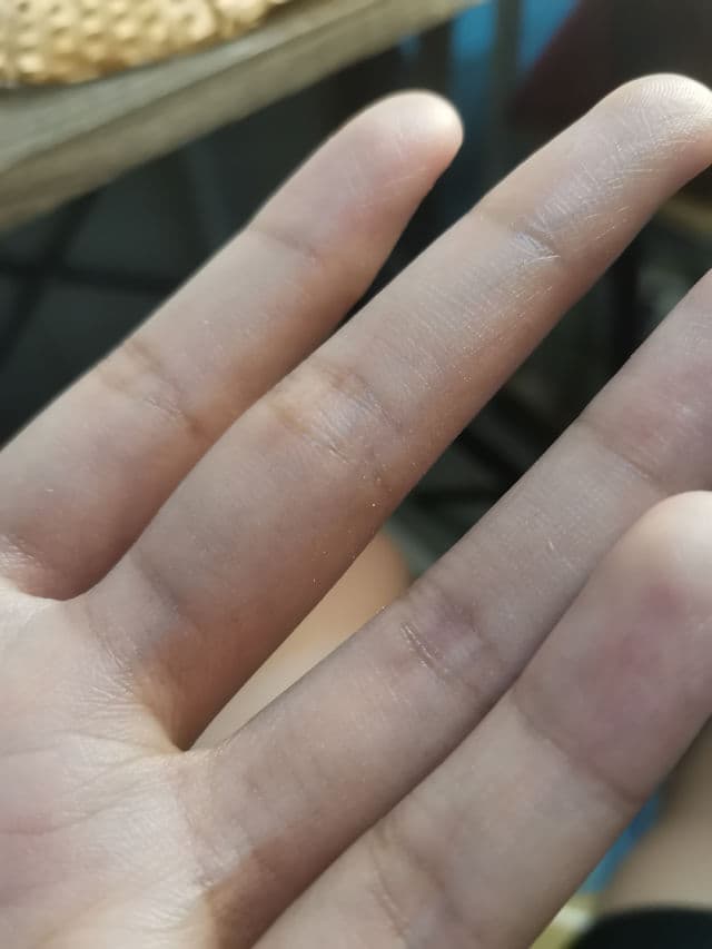 Oxecure Acne Sunscreen SPF50+ PA++++ review photo by reviewsbynor