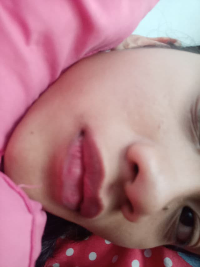 Avoskin Your Skin Bae Azeclair 10% + Kombucha 3% + Niacinamide 2,5% Vaccine Serum review photo by novikaglorysiregar