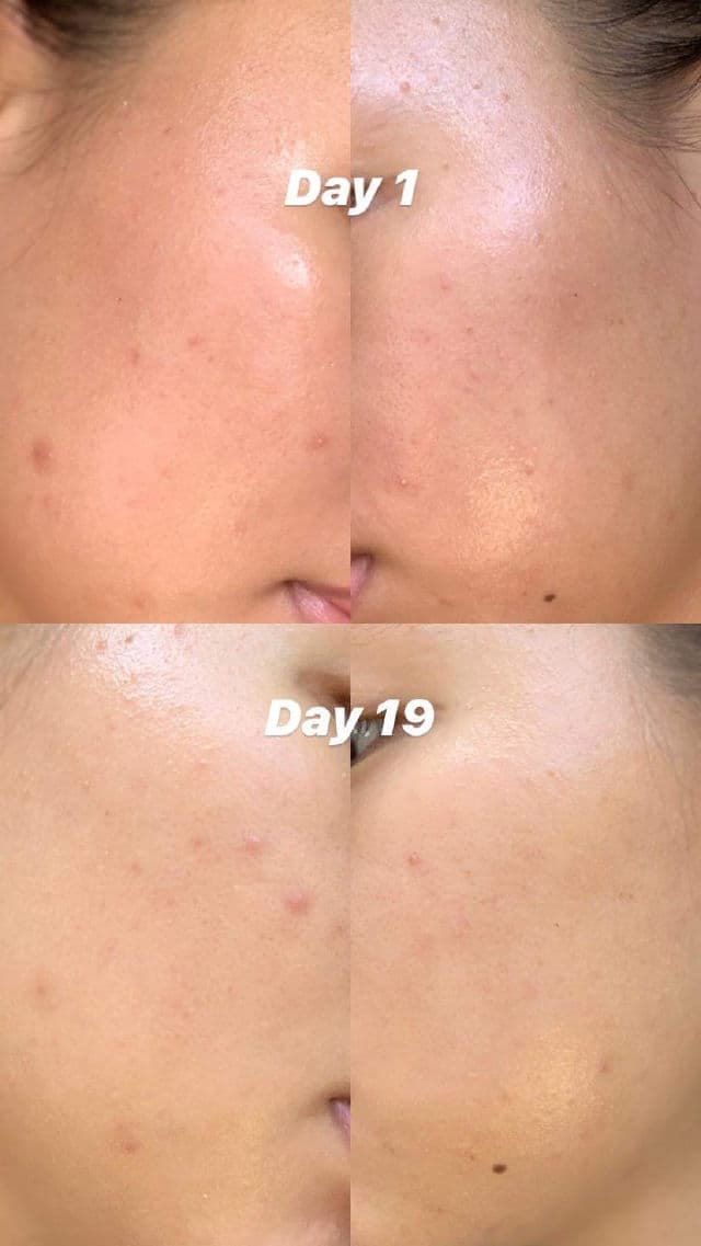 Gratitude Bar Bright Drops - Alpha Arbutin Hyaluronic Acid Vitamin B3 Brightening Serum review photo by nyannieee