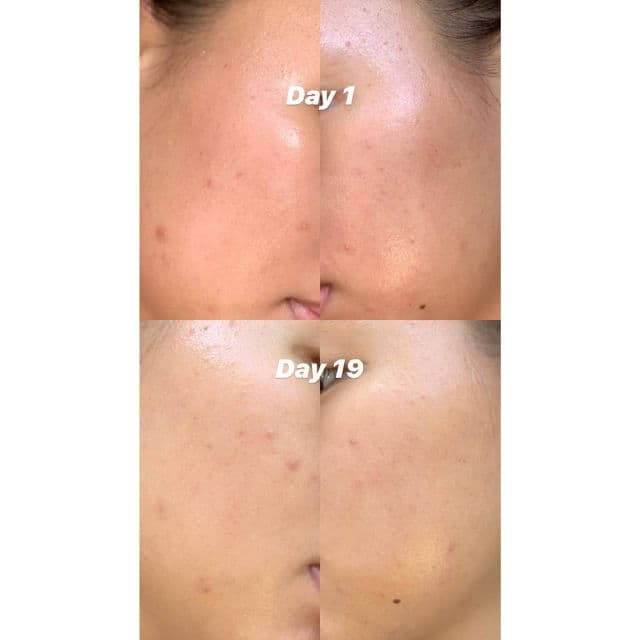 Gratitude Bar Alpha Arbutin + Hyaluronic Acid + Vitamin B3 Brightening Serum review photo by nyannieee