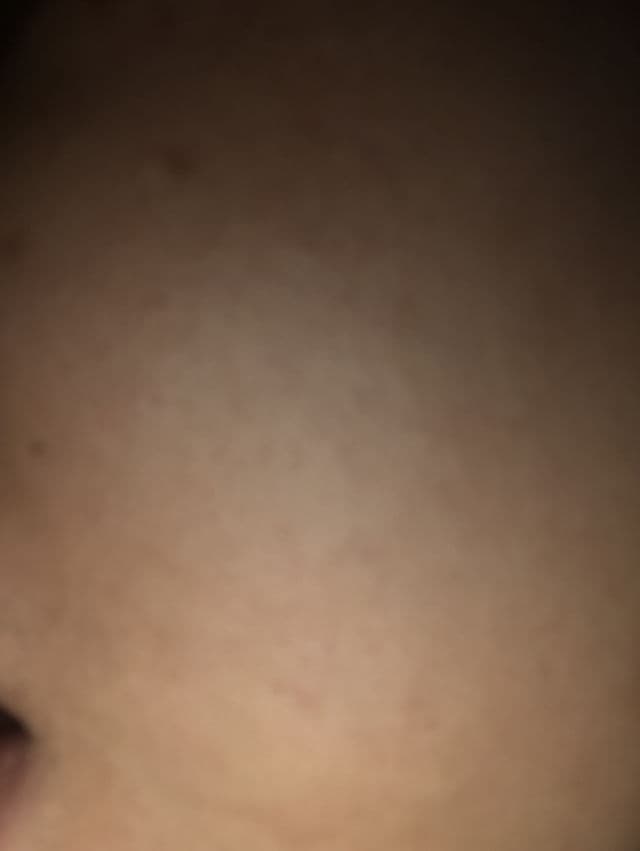 Avoskin Your Skin Bae Lactic Acid 10% + Kiwi Fruit 5% + Niacinamide 2.5% High Dose Serum review photo by pickyimel