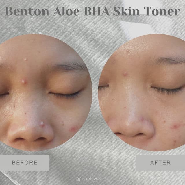 BENTON Aloe BHA Skin Toner review photo by poetrydiane