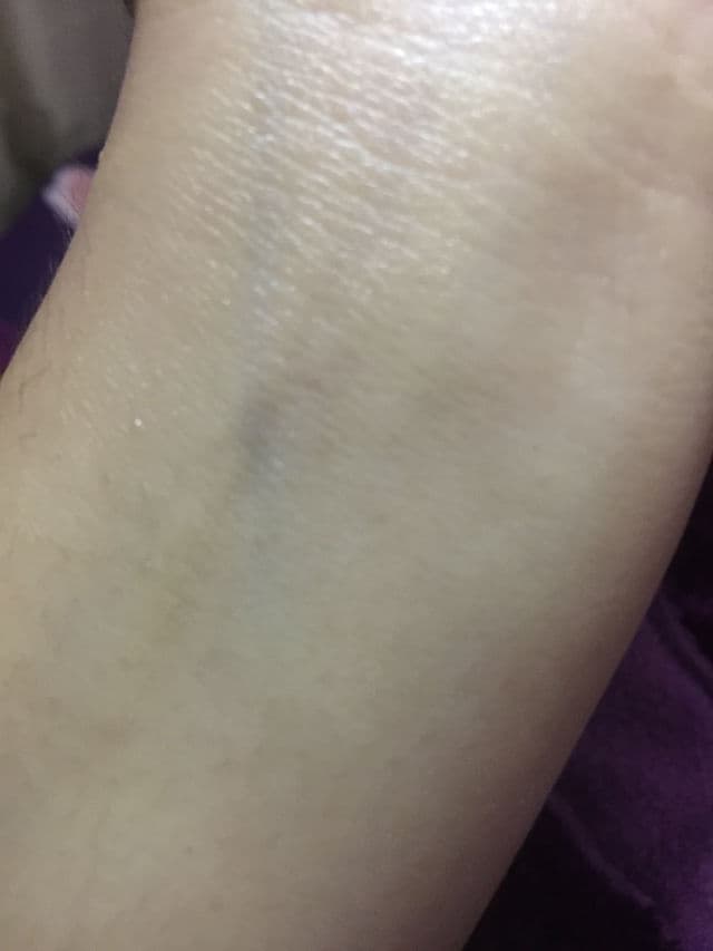 Brinton Acmist Moisturizing Cream Gel review photo by pratistha