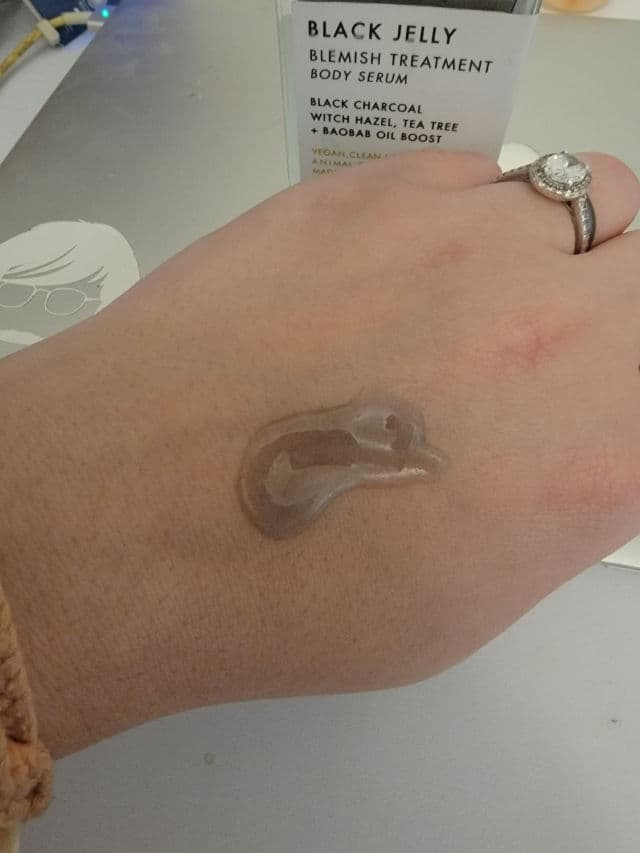 Truly Black Jelly Blemish Treatment Body Serum review photo by raereviewenster