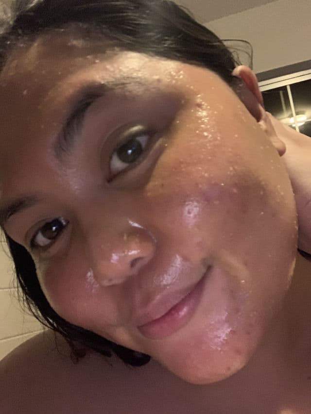 Sei Bella Vitamin C Exfoliator Mask review photo by rainabunz