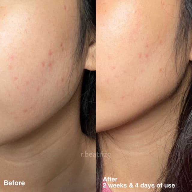 Snail White Beauty Glow Drops review photo by rbeatrizg