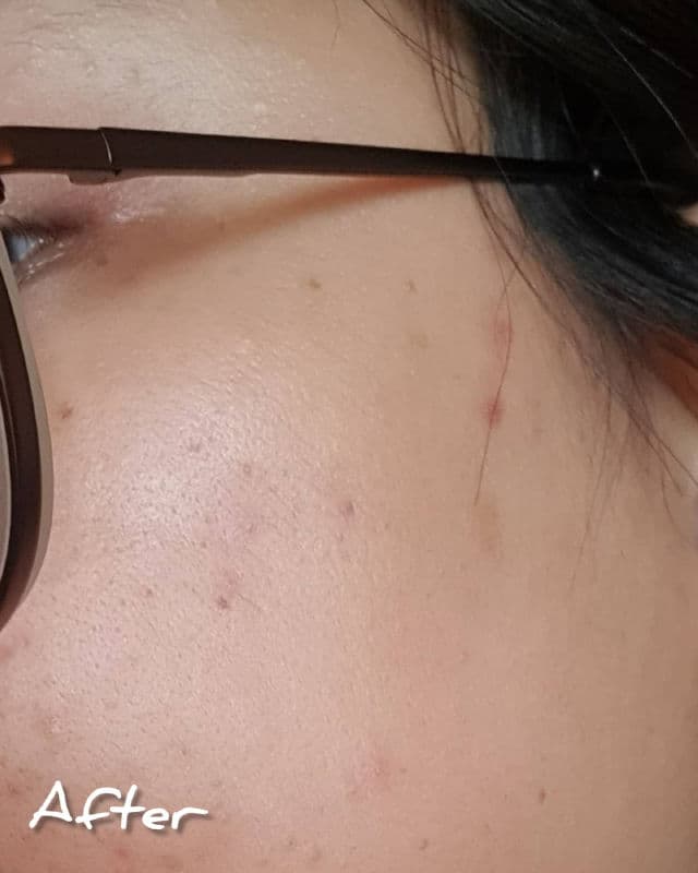 Gratitude Bar Acne Clear Drops review photo by rheadoo