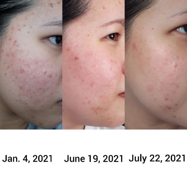 BENTON Deep Green Tea Toner review photo by riapark13