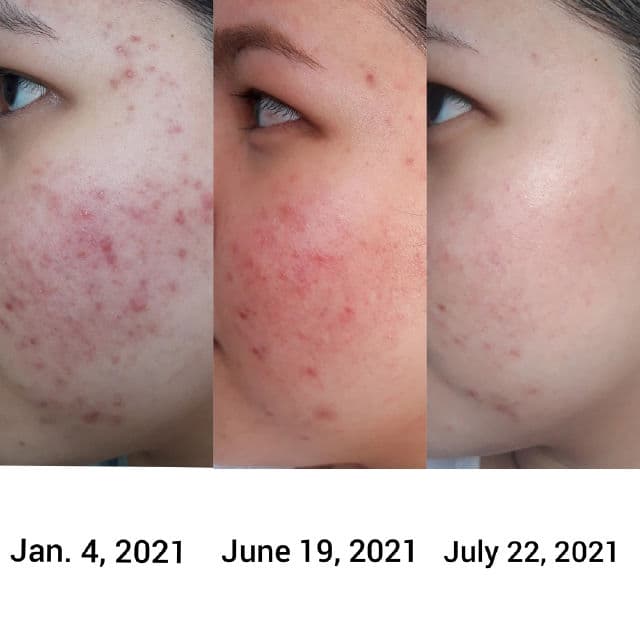 BENTON Deep Green Tea Toner review photo by riapark13