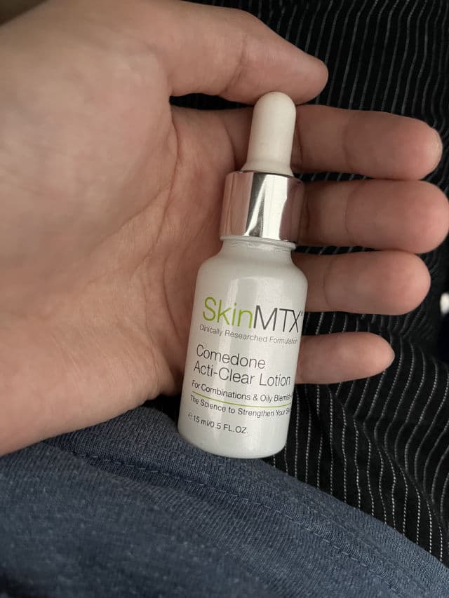 SkinMTX Comedone Acti-Clear Lotion review photo by rollin