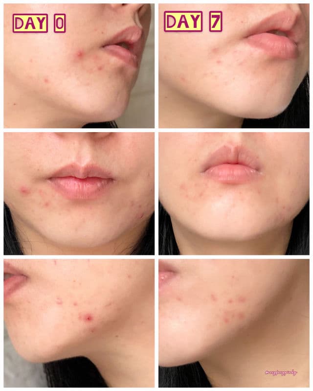 datglowskin 2% Niacinamide + Vit B5 Skin Tonic review photo by roxyfoxypinky