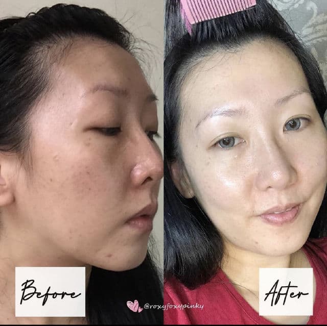 Lovila Glow Activation Booster Serum review photo by roxyfoxypinky