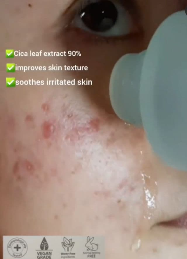 The Plant Base AC Clear Pure N Skin Lotion review photo by roza