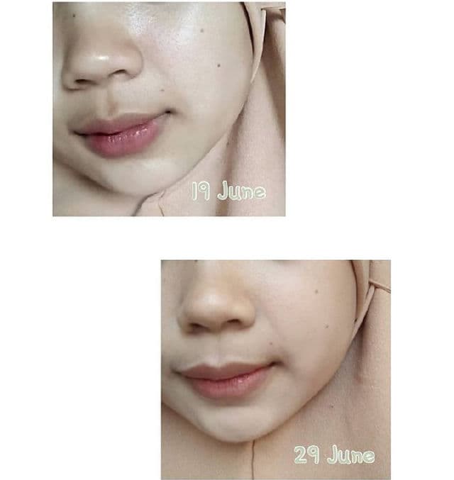 Nadfaskin Hyaluronic Acid Serum review photo by sarahnurazizah