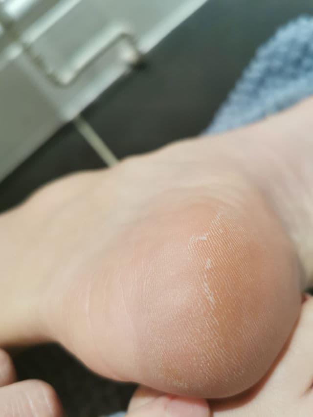 Tropic Skincare Face Smooth Brightening Polish	 review photo by shaan12