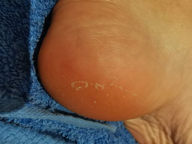 Tropic Skincare Face Smooth Brightening Polish	 review photo by shaan12