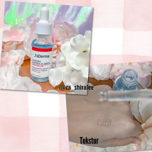 J'sDerma Acnetrix Control AC Serum review photo by shiralee