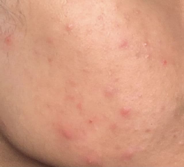 Farmstay Dermacube Probiotics Therapy Ampoule Serum review photo by shiza