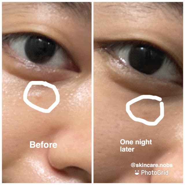 The Potions Tea Tree Oil Serum review photo by skincarenobs