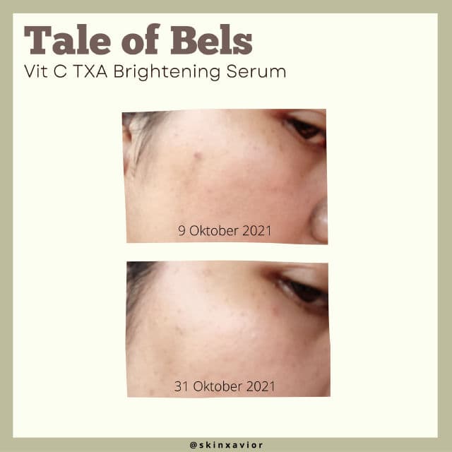 Tale of Bels Vit C TXA Brightening Serum review photo by skinxavior