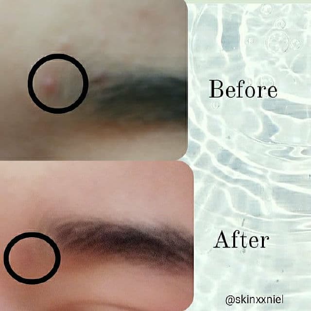 SKIN1004 Madagascar Centella Ampoule review photo by skinxxniel