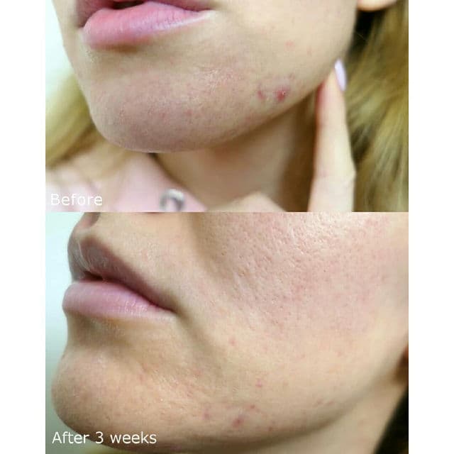 Pyunkang Yul ACNE Toner review photo by sofiia