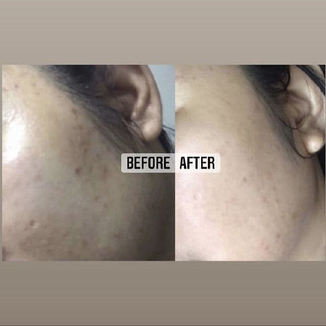 AXIS-Y Dark Spot Correcting Glow Serum review photo by sskincarediaryy